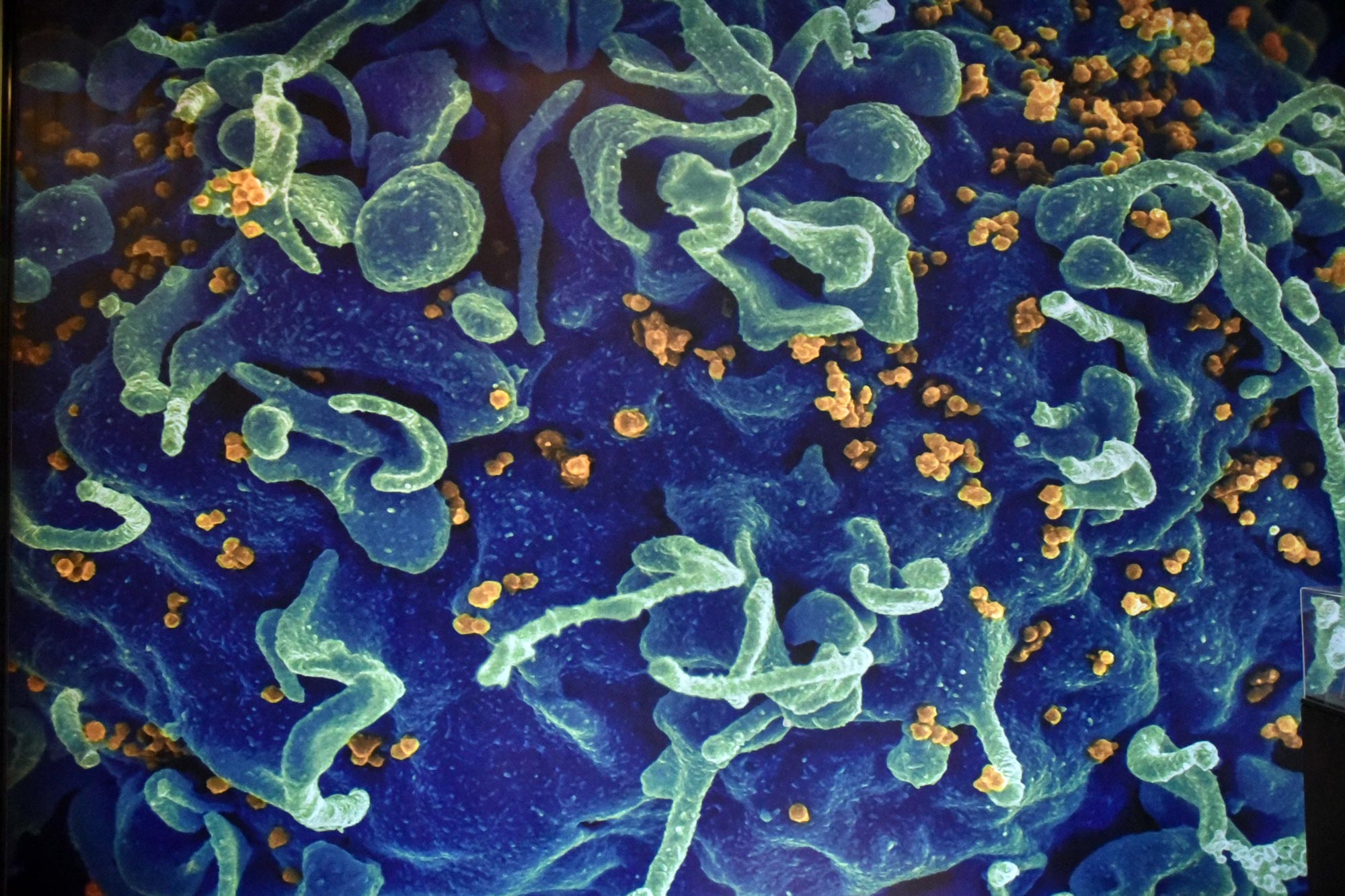 Exposición “Del virus a la epidemia: amenazas invisibles en un mundo globalizado” en la Biblioteca Nicanor Parra